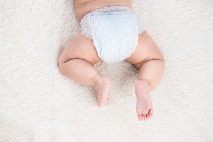 Asyalı kız bebek bacaklarında doğum lekesi